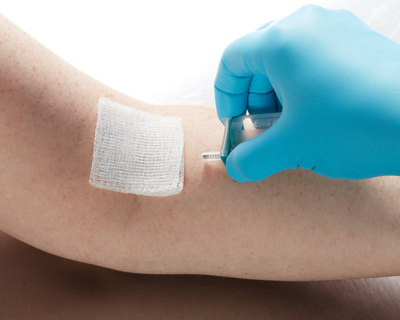 EPBCP-venipuncture-Post