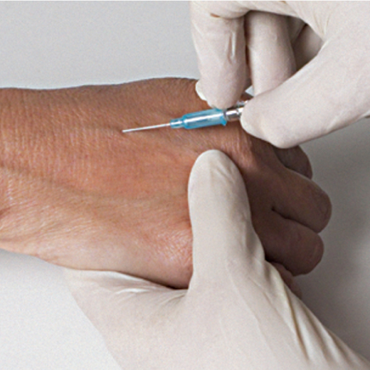 VP-catheter1