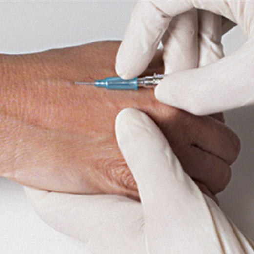 VP-catheter2