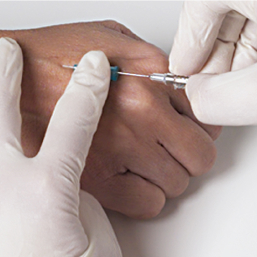 VP-catheter3