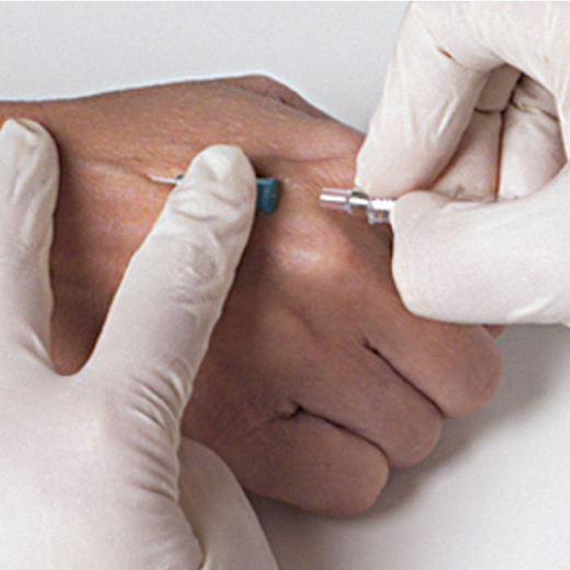 VP-catheter4